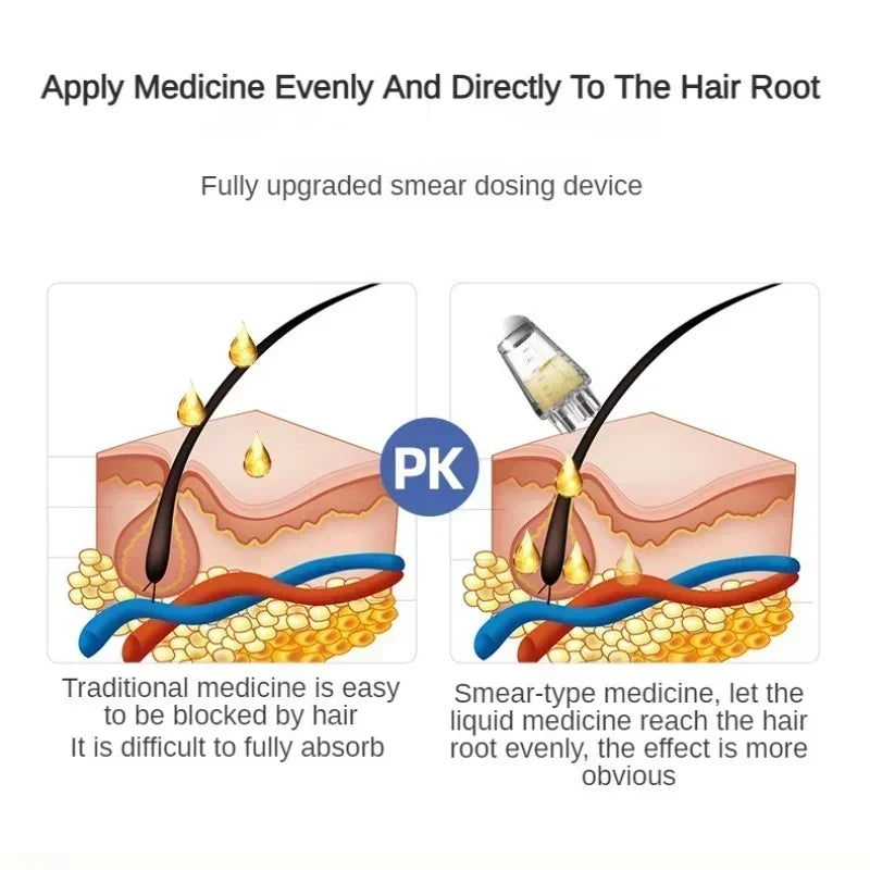 FitGearly anti hair loss essential oil liquid with guiding massager for scalp health and hair growth support.
